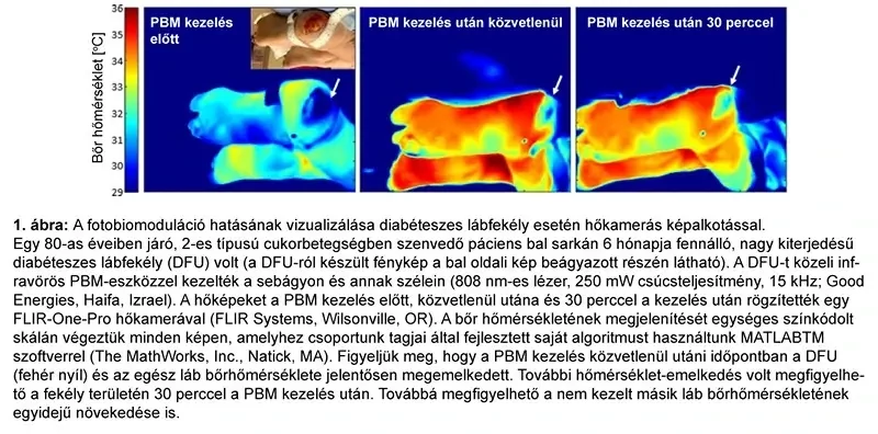 b-cure-hoterkep