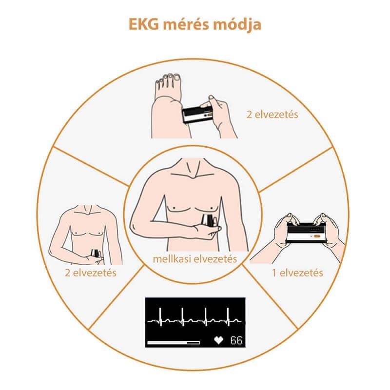 viatom-armfit-vernyomasmero-ekg-funkcioval-ekg-meres-modja