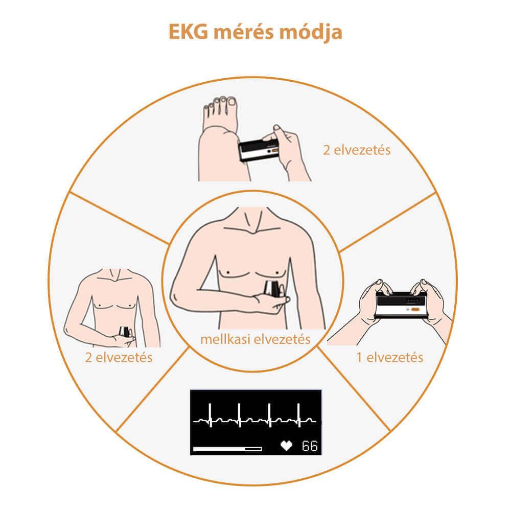 viatom-armfit+-vernyomasmero-ekg-funkcioval