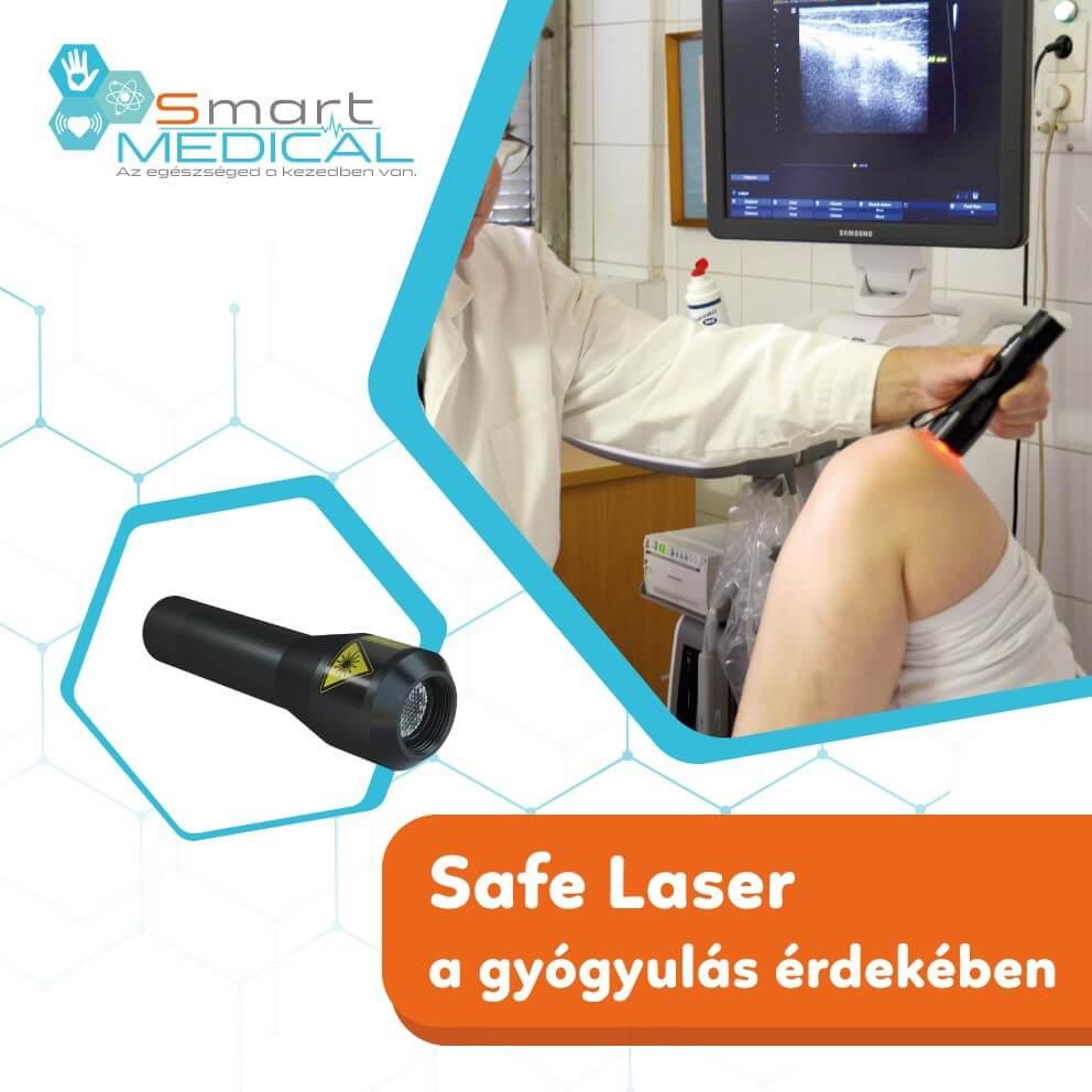 safe-laser-izulet-kezelese