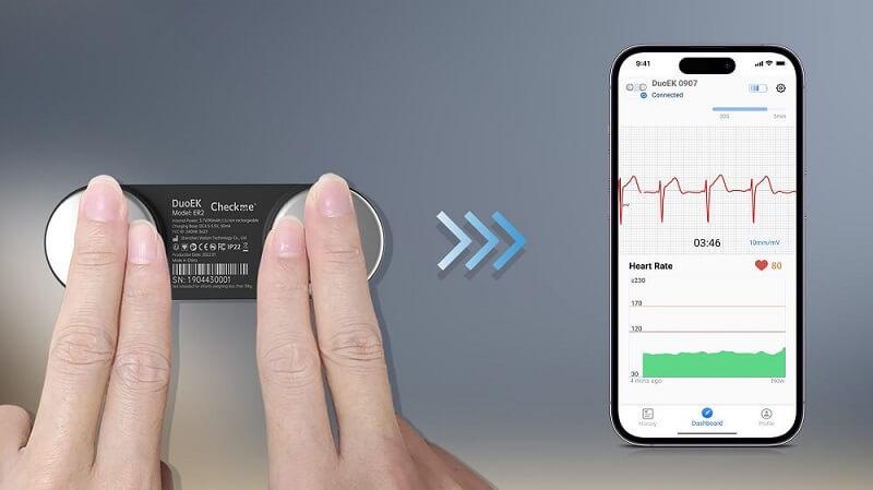duoekg-szemelyi-ekg-kontroll-bluetooth-csatlakozas