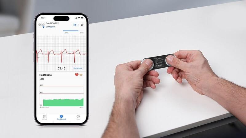 duoekg-szemelyi-ekg-kontroll-monitorizalas