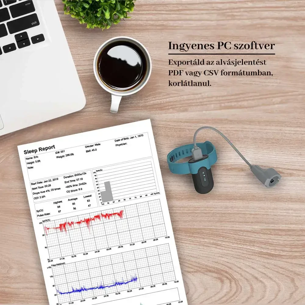 viatom-sleepu-oxigenmonitor-po3-ingyenes-pc-szoftver