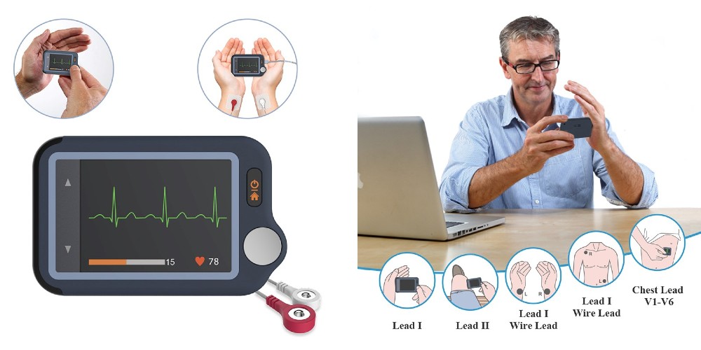 Viatom készülékek – Szemmel tartják a legfontosabb értékeket - Smartmedical