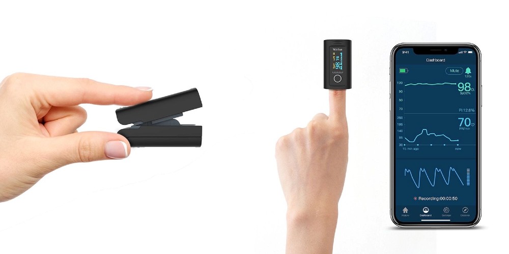 Viatom készülékek – Szemmel tartják a legfontosabb értékeket - Smartmedical