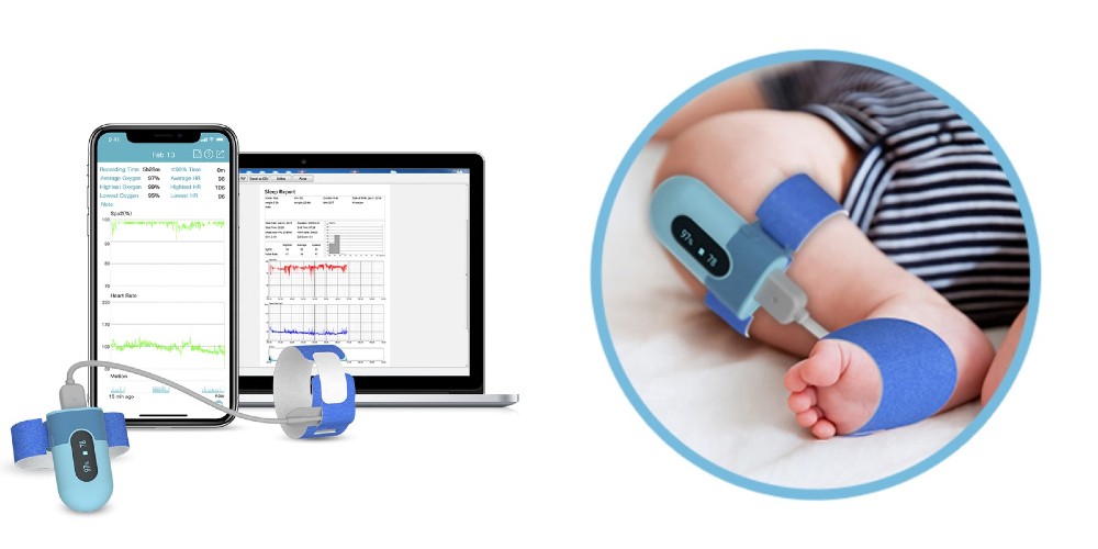 Viatom készülékek – Szemmel tartják a legfontosabb értékeket - Smartmedical