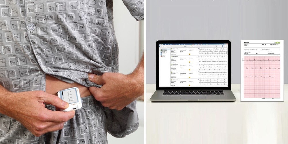 Viatom készülékek – Szemmel tartják a legfontosabb értékeket - Smartmedical